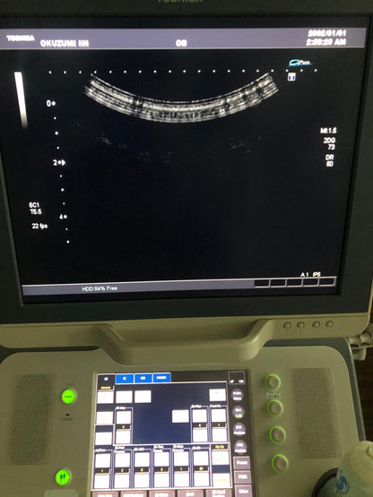 ..Toshiba PVT-375BT convex probe