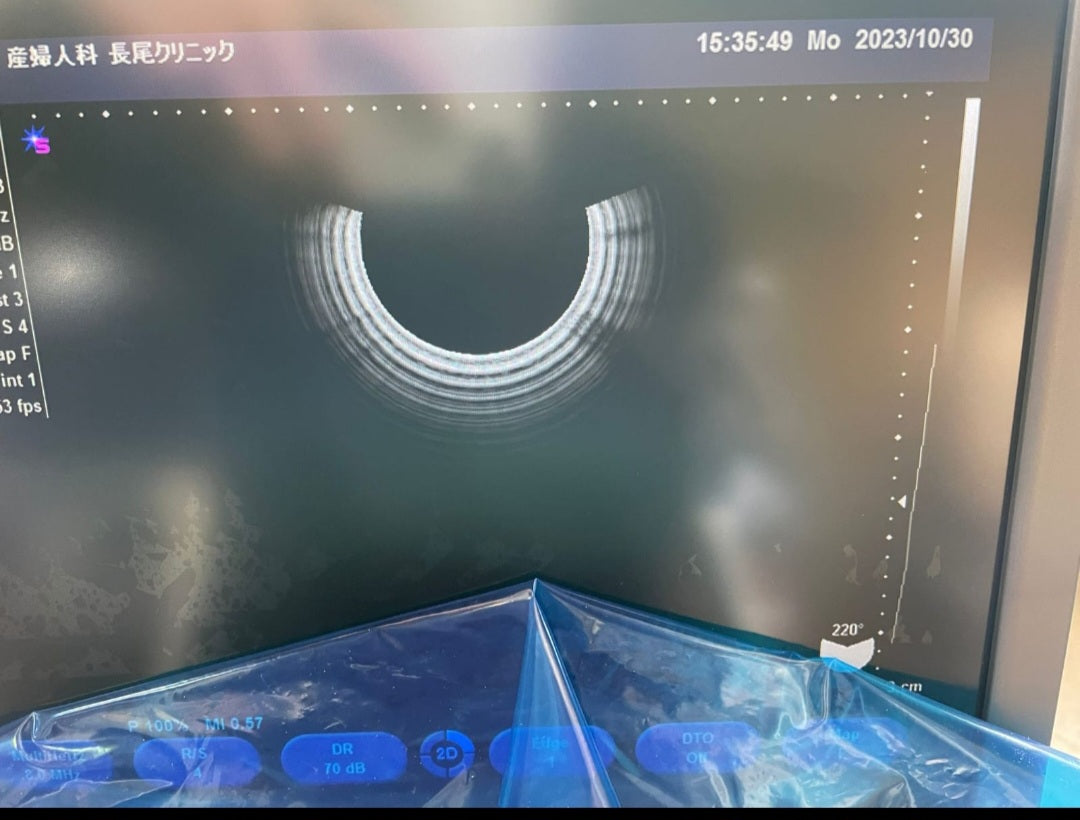 Siemens sonovista fx with 2 pcs TV probes. - Japan Medical Company LTD