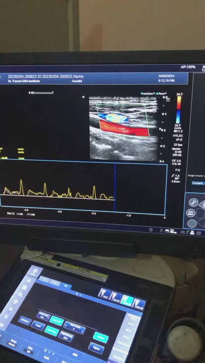 ..Toshiba i11LX3 linear probe