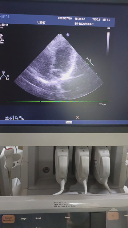 Philips s5-1 cardiac probe sn. 03FG2X checked dxb IS (MW)