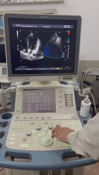 Toshiba Aplio XG Ultrasound machine with adult cardiac probe