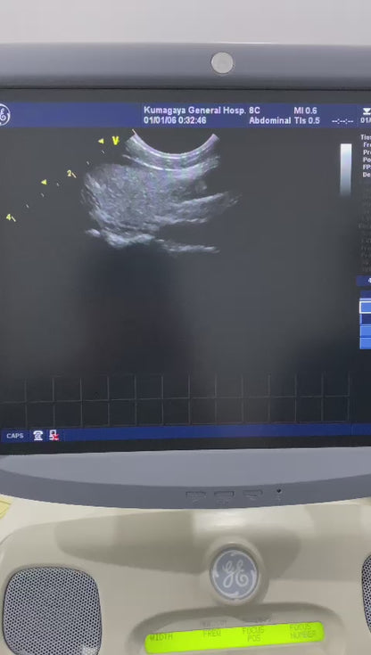 ..GE 8C Micro convex arrange ultrasound transducer. Mfg 2013