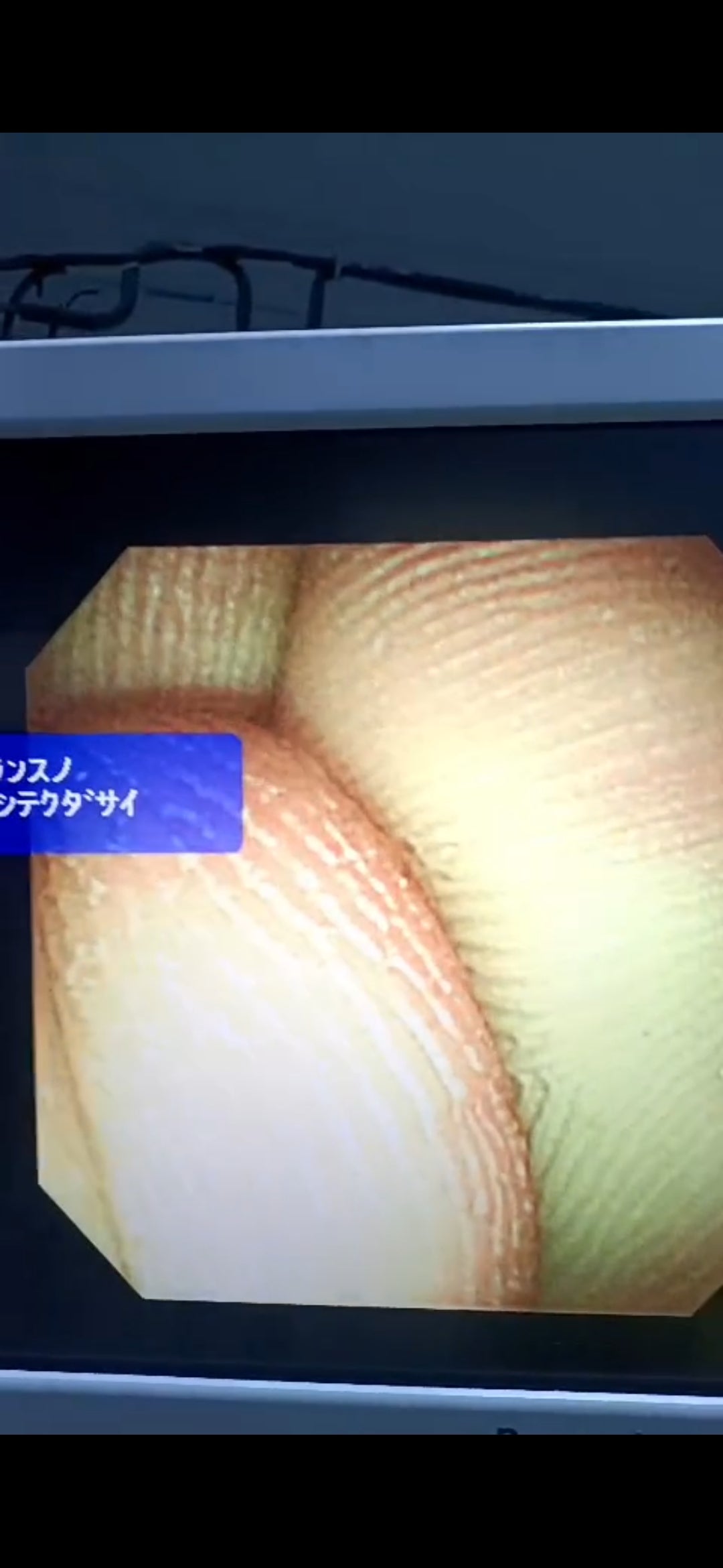 Olympus JF-260V Duodenoscope dxb