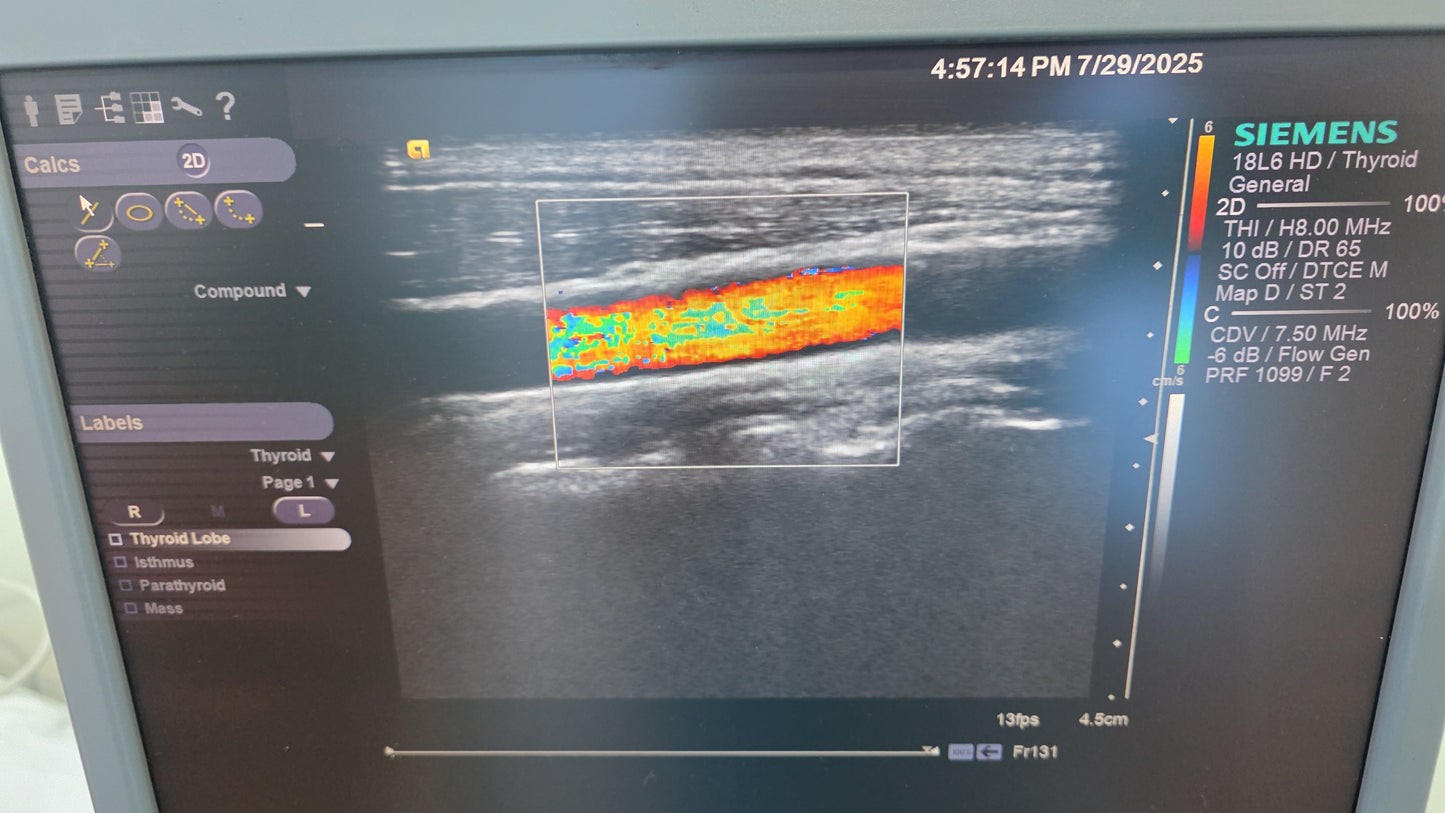 Siemens Acuson 18L6 HD Ultrasound Probe MFg: 2019 DXB checked ok