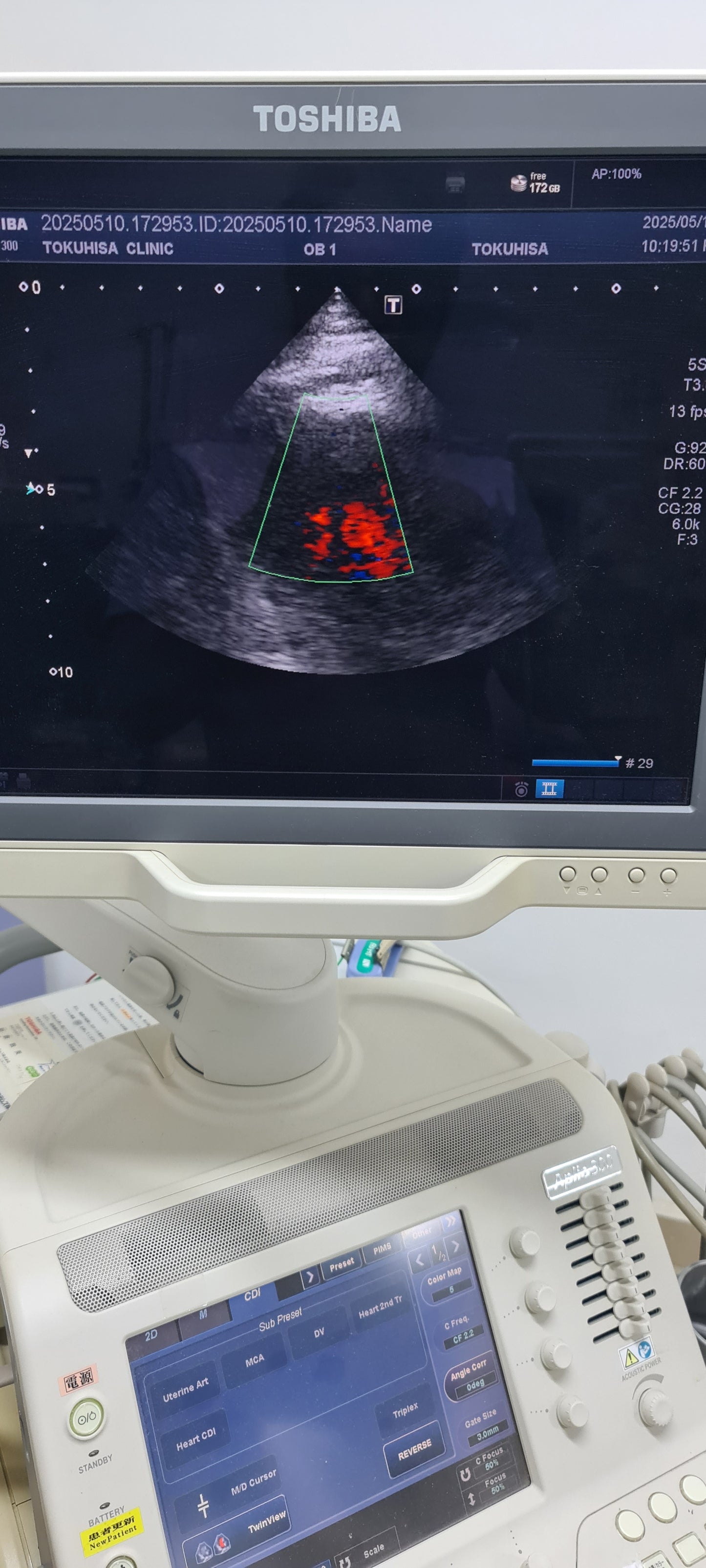 Toshiba 5S1 cardiac Prob SN: TDA1324614 checked DXB