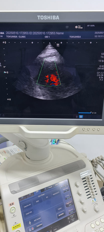 Toshiba 5S1 cardiac Prob SN: TDA1324614 checked DXB