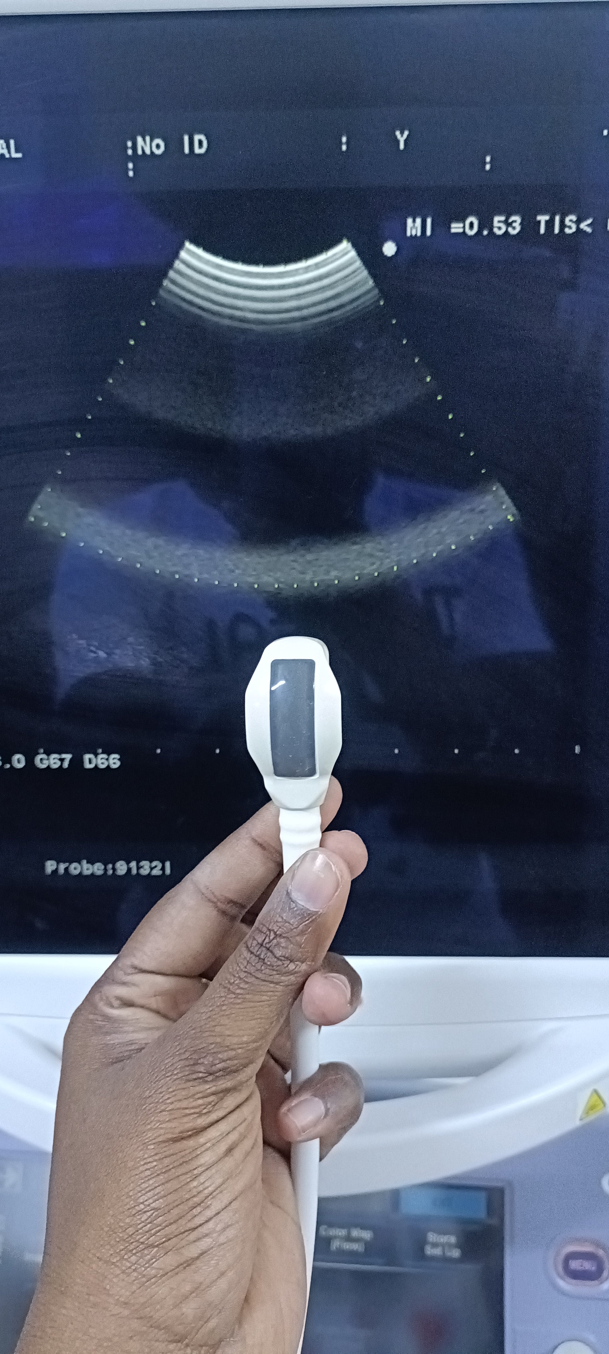 Aloka ust-91321 sn. 202A7424 (MW) checked dxb IS - Japan Medical Company LTD