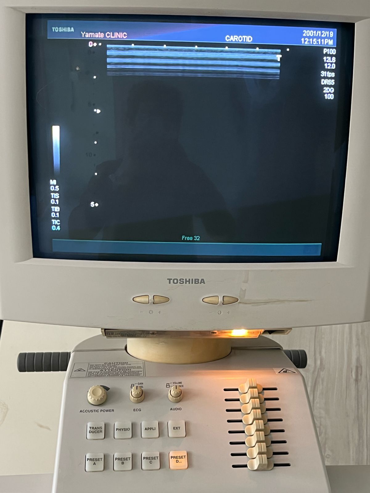 P...Toshiba Linear Probe