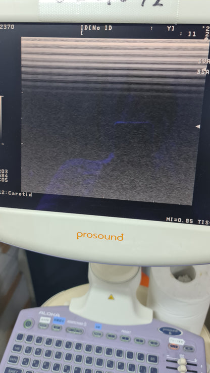Aloka UST-5413 prob L  checked SN. X0032974