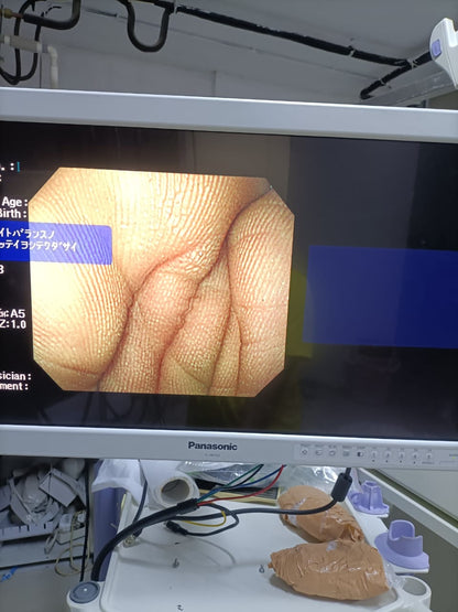 Olympus GIF-Q260 Gastroscope Flexible Video Endoscope DXB