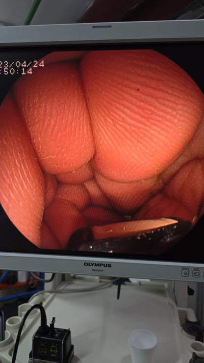 Fujinon gastroscopy EG-530UT2 S.NO: 1U038A021 checked DXB