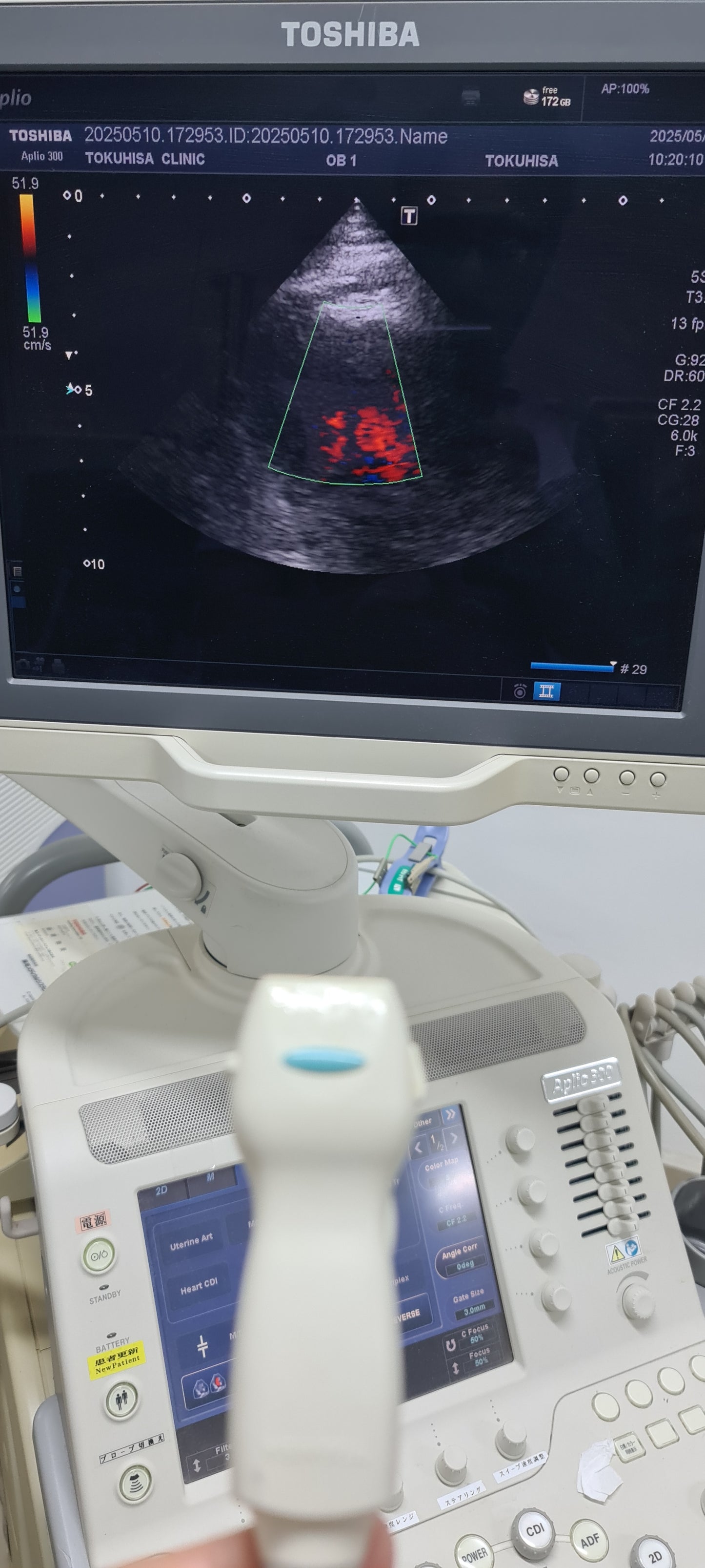 Toshiba 5S1 cardiac Prob SN: TDA1324614 checked DXB