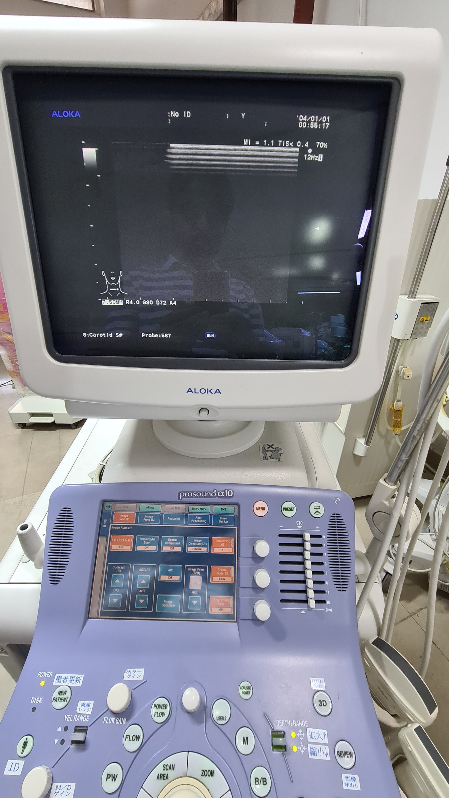 Z..Aloka UST 5413 linear Probe checked dxb