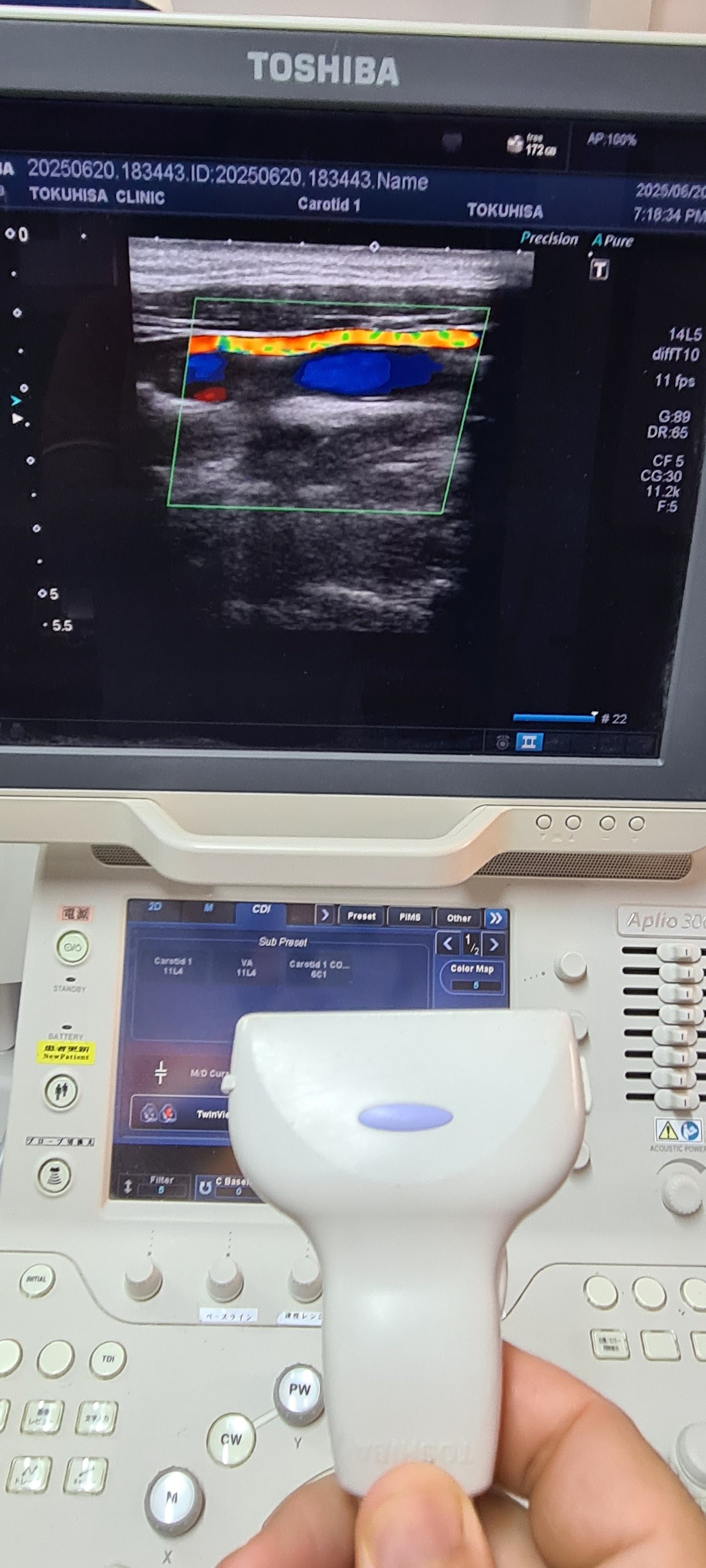 Toshiba PLT-1005BT Linear Probe SN: FSB16X4151 Dxb checked