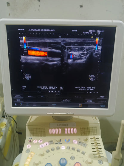 Hitachi avius Linear probe