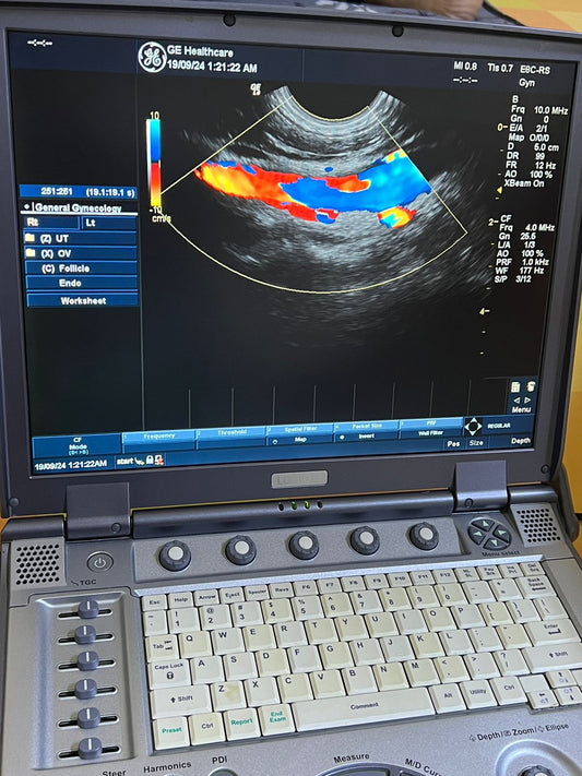 GE E8C-RS Probe, Trabsducer 3/10