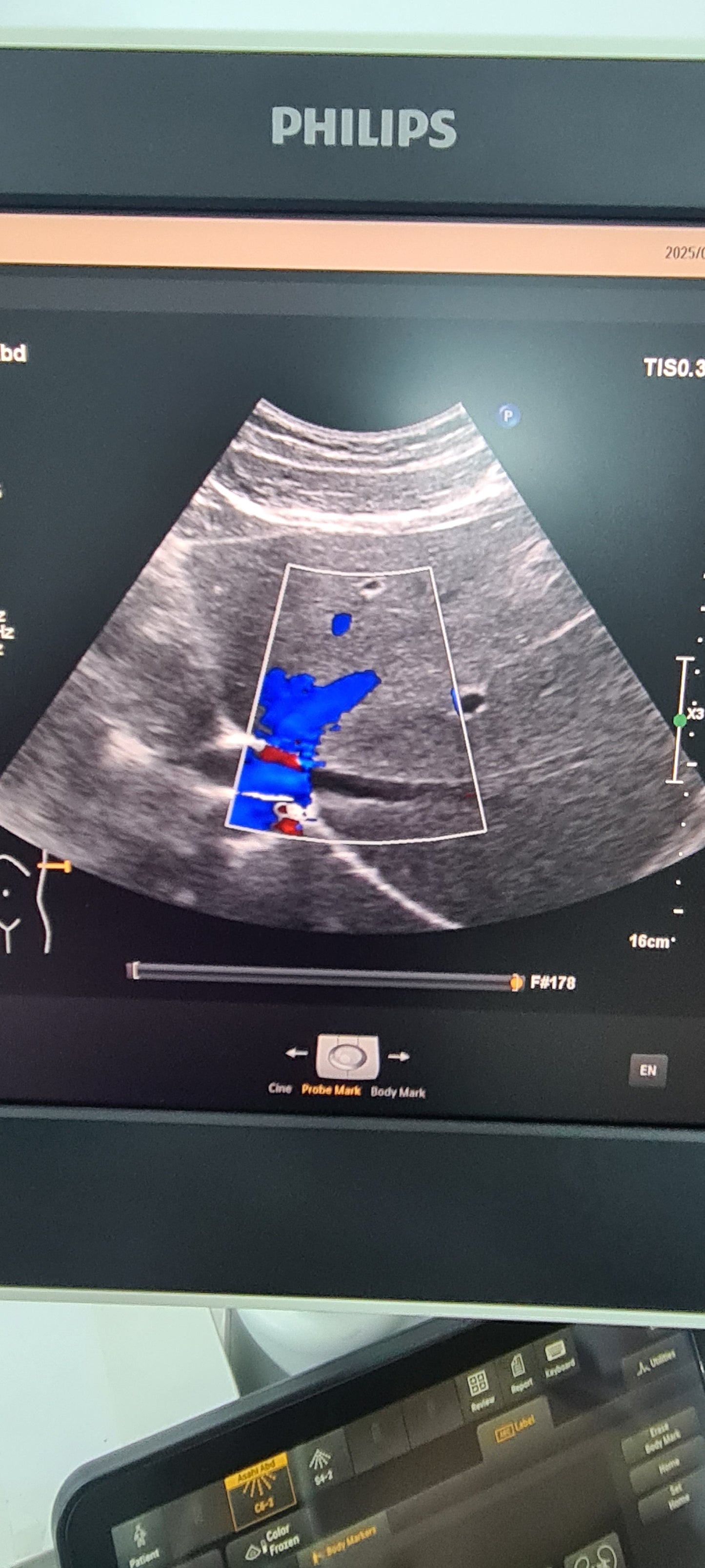 Philips C6-2 Convex probe SN: B16QFF checked DXB