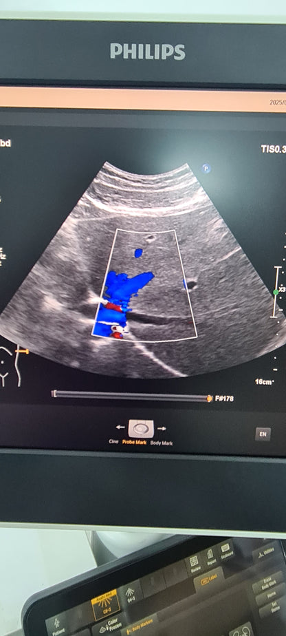 Philips C6-2 Convex probe SN: B16QFF checked DXB
