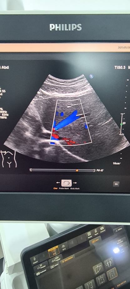 Philips C6-2 Convex probe SN: B16QFF checked DXB