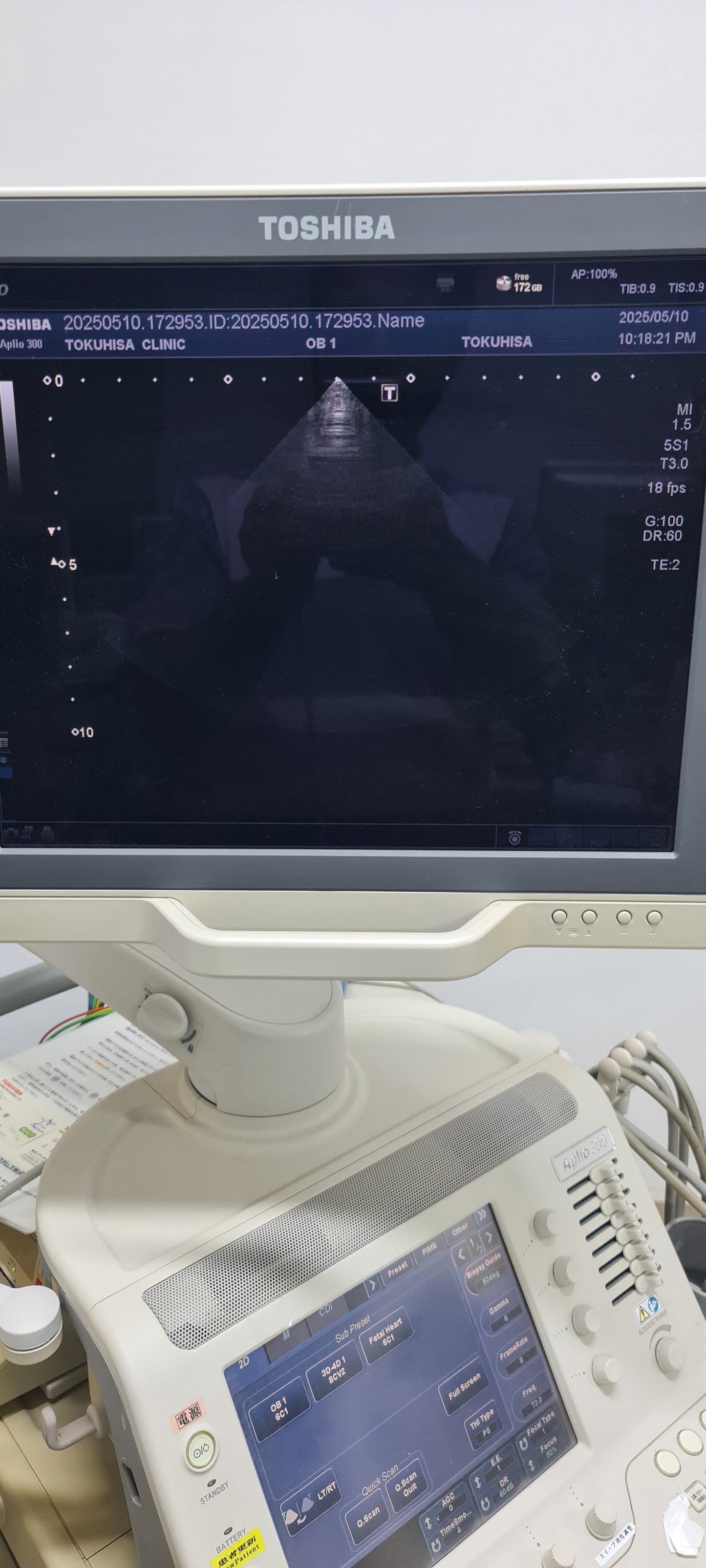 Toshiba 5S1 cardiac Prob SN: TDA1324614 checked DXB