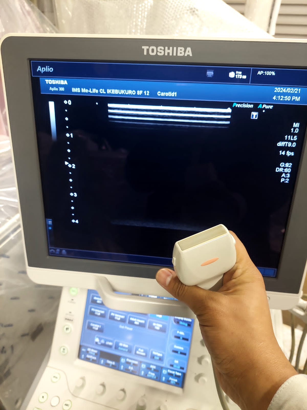 Toshiba Aplio 300 with convex(PVT-375BT), PLT(704AT), PLT(805AT) probes. - Japan Medical Company LTD