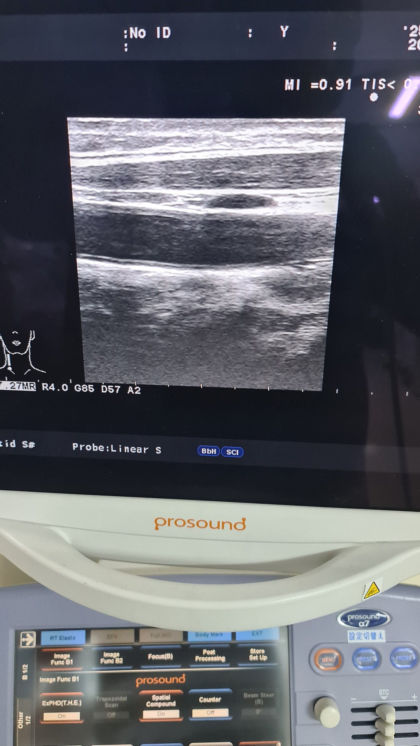 Aloka prob UST-5412 SN. M03744 checked