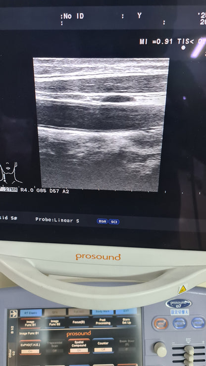 Aloka prob UST-5412 SN. M03744 checked