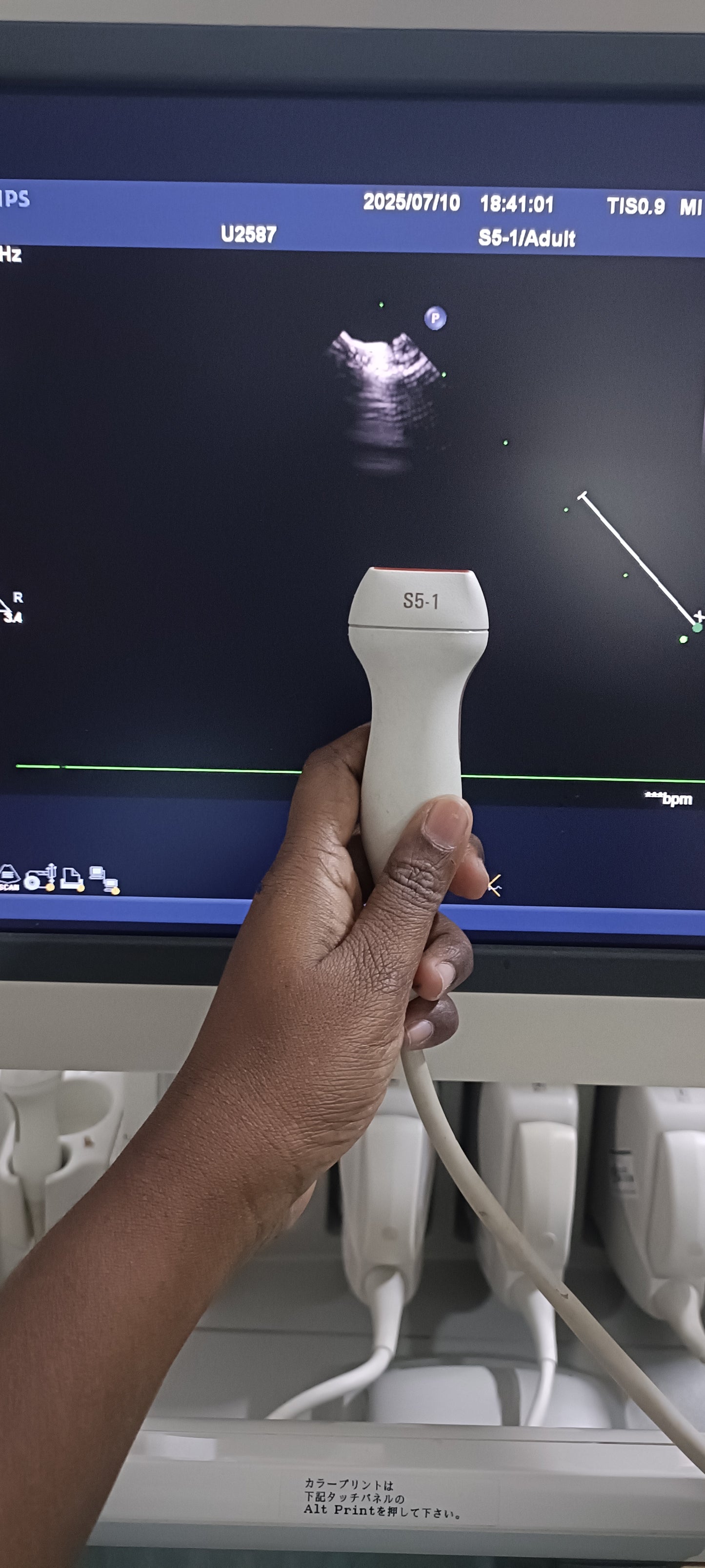 Philips s5-1 cardiac probe sn. 03FG2X checked dxb IS - Japan Medical Company LTD