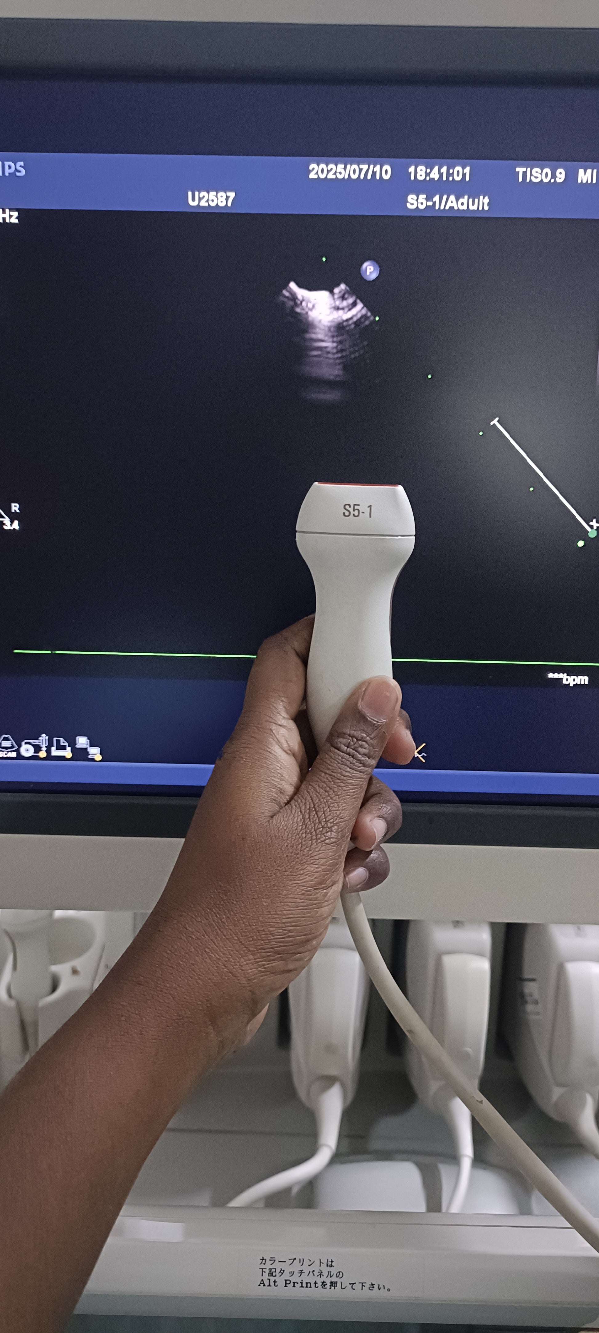 Philips s5-1 cardiac probe sn. 03FG2X checked dxb IS - Japan Medical Company LTD