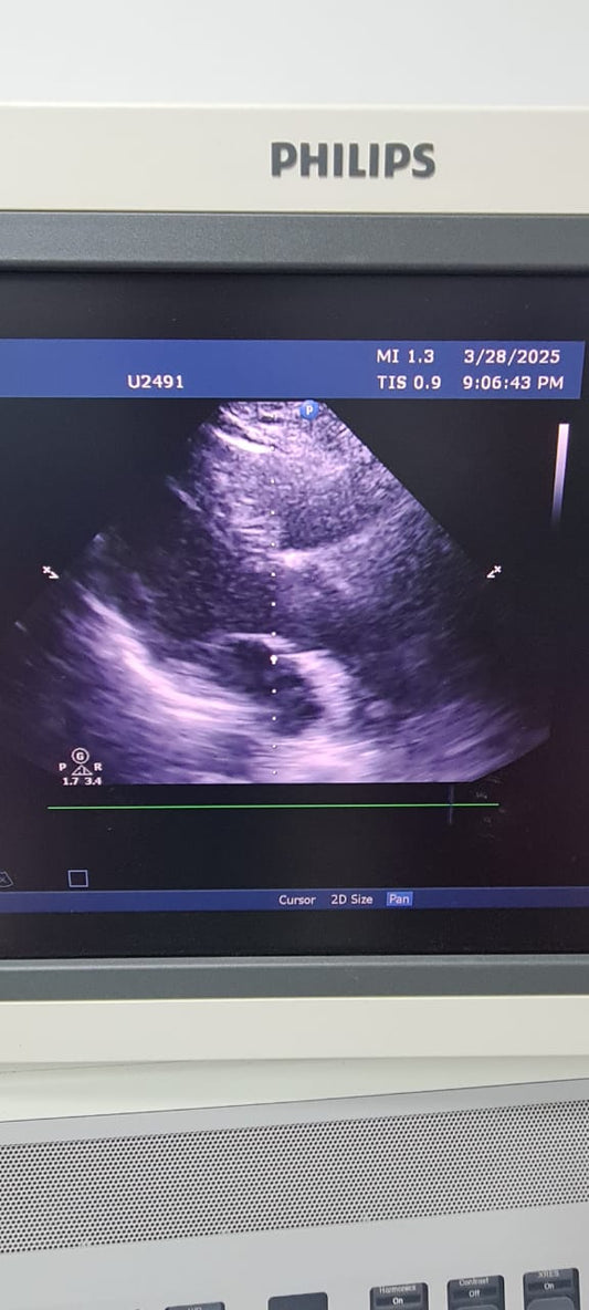 Philips S5-2 Prob cardiac checked