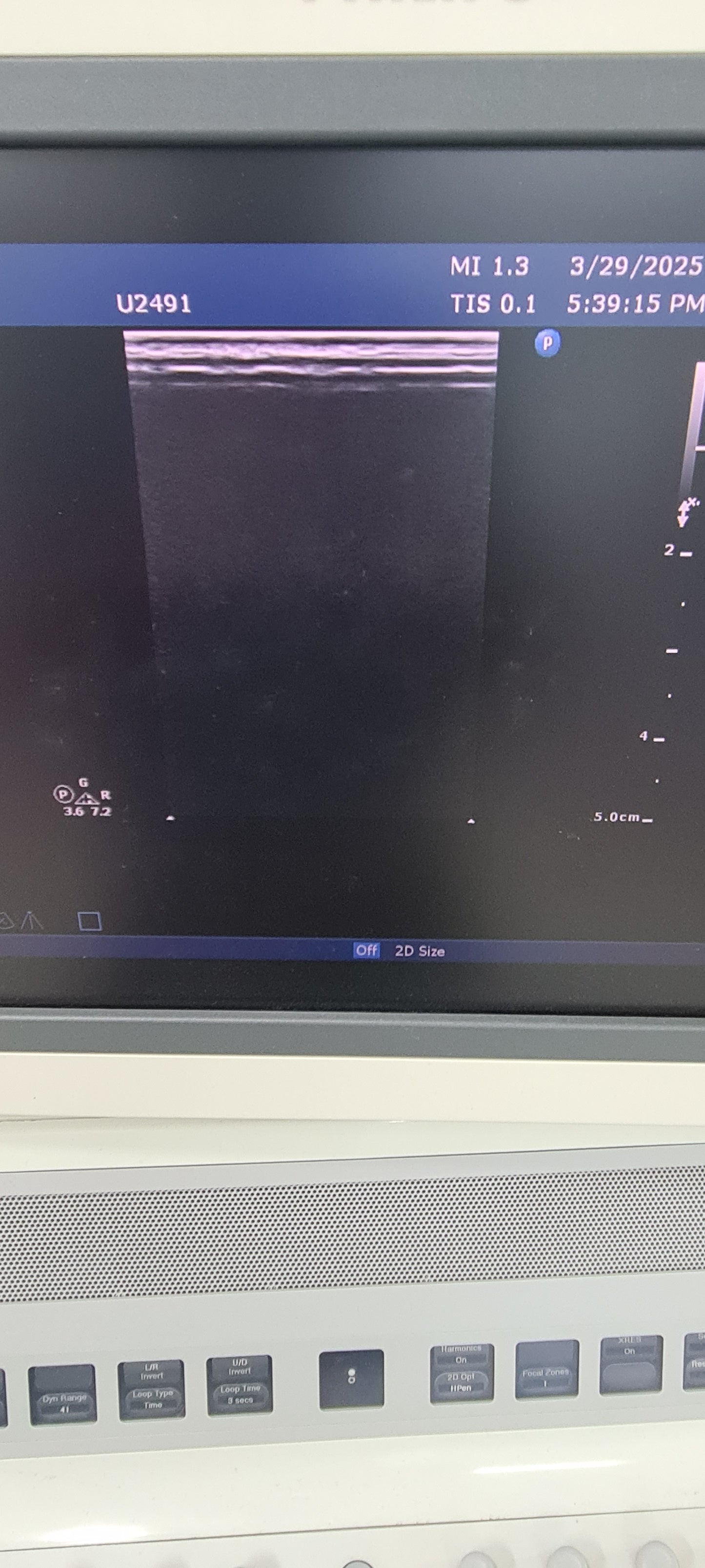 Philips L12-3 prob checked Ultrasound Transducer SN.2PFNQ PN. 453561182101