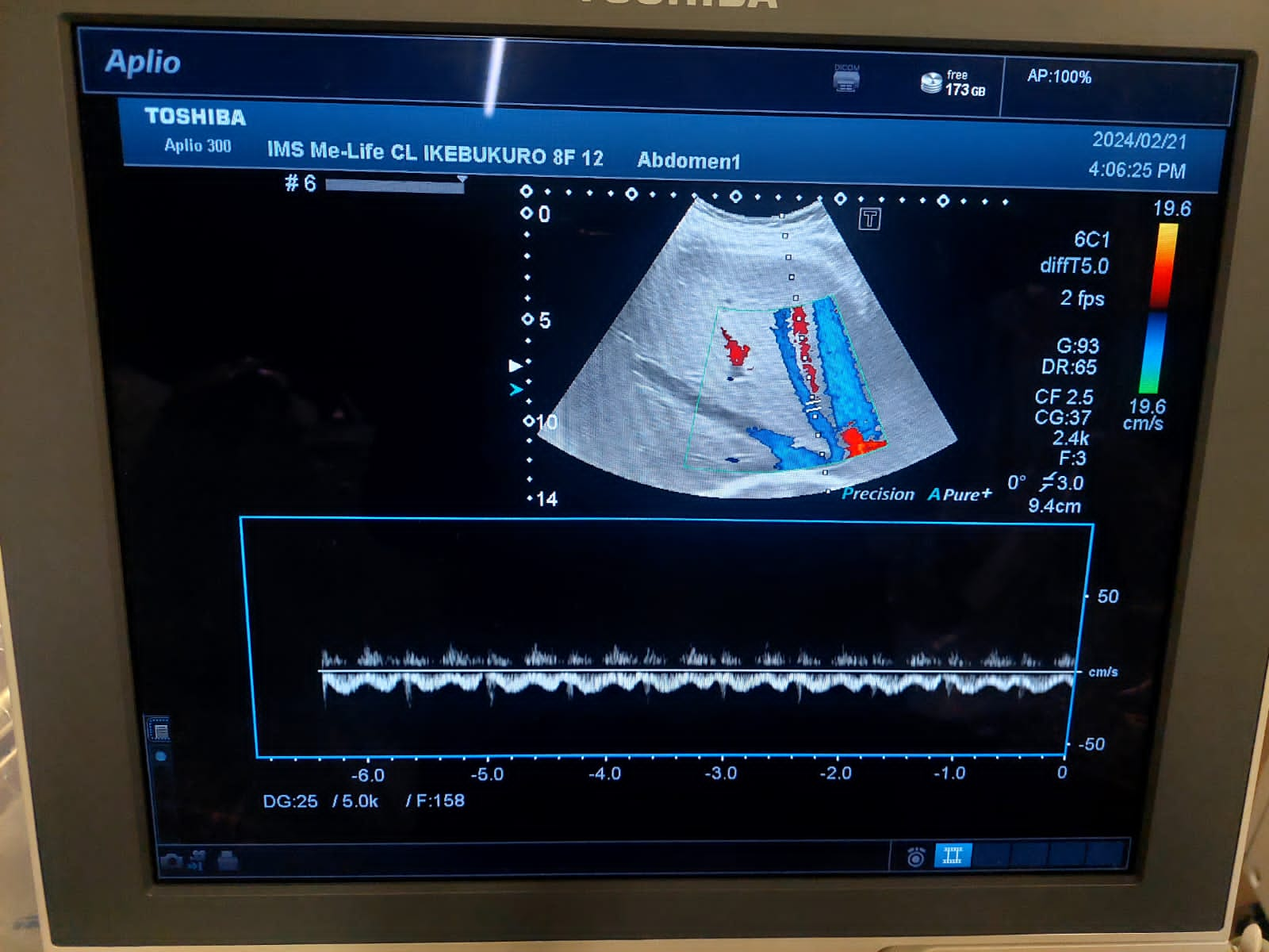 Toshiba Aplio 300 with convex(PVT-375BT), PLT(704AT), PLT(805AT) probes. - Japan Medical Company LTD