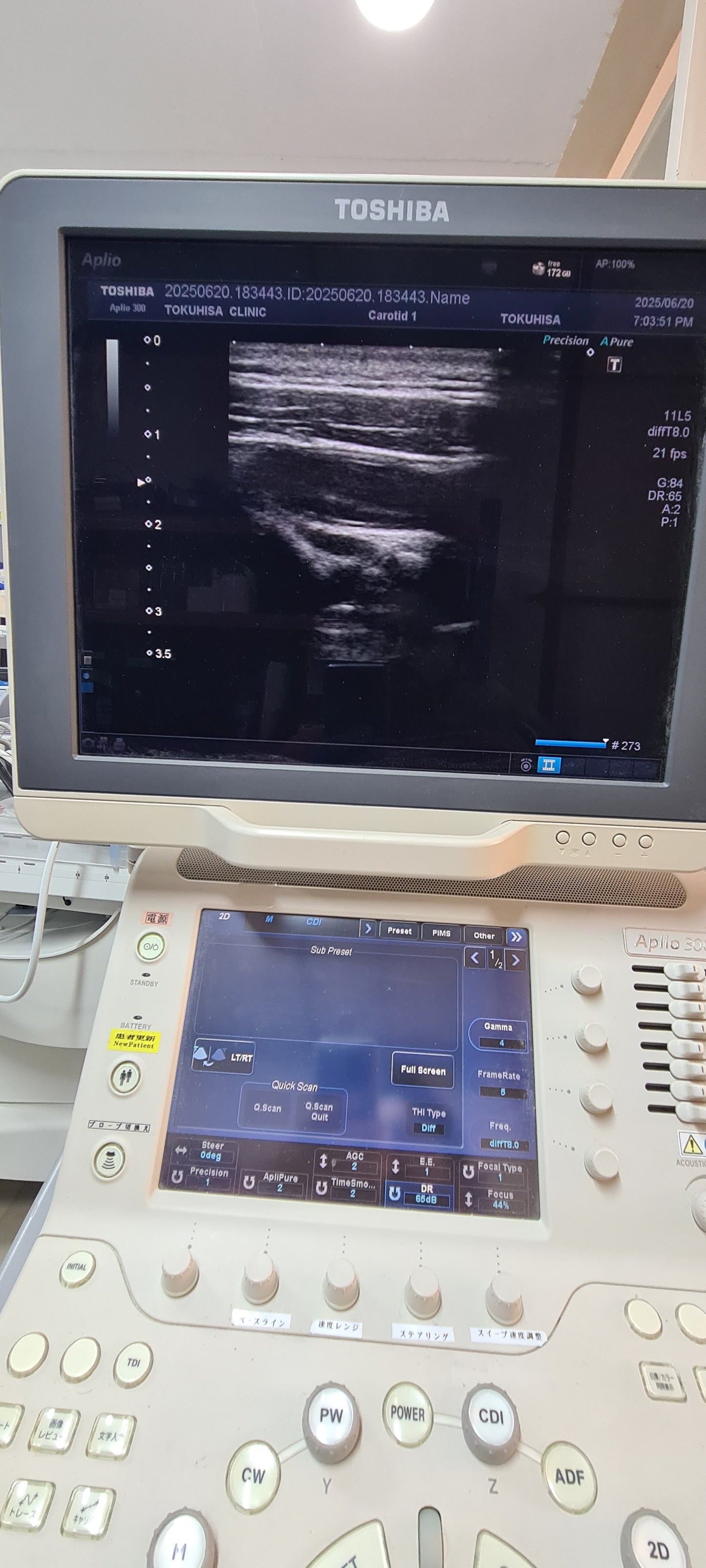 Toshiba PLT-704AT Linear probe SN: TDA12Y5713 Dxb