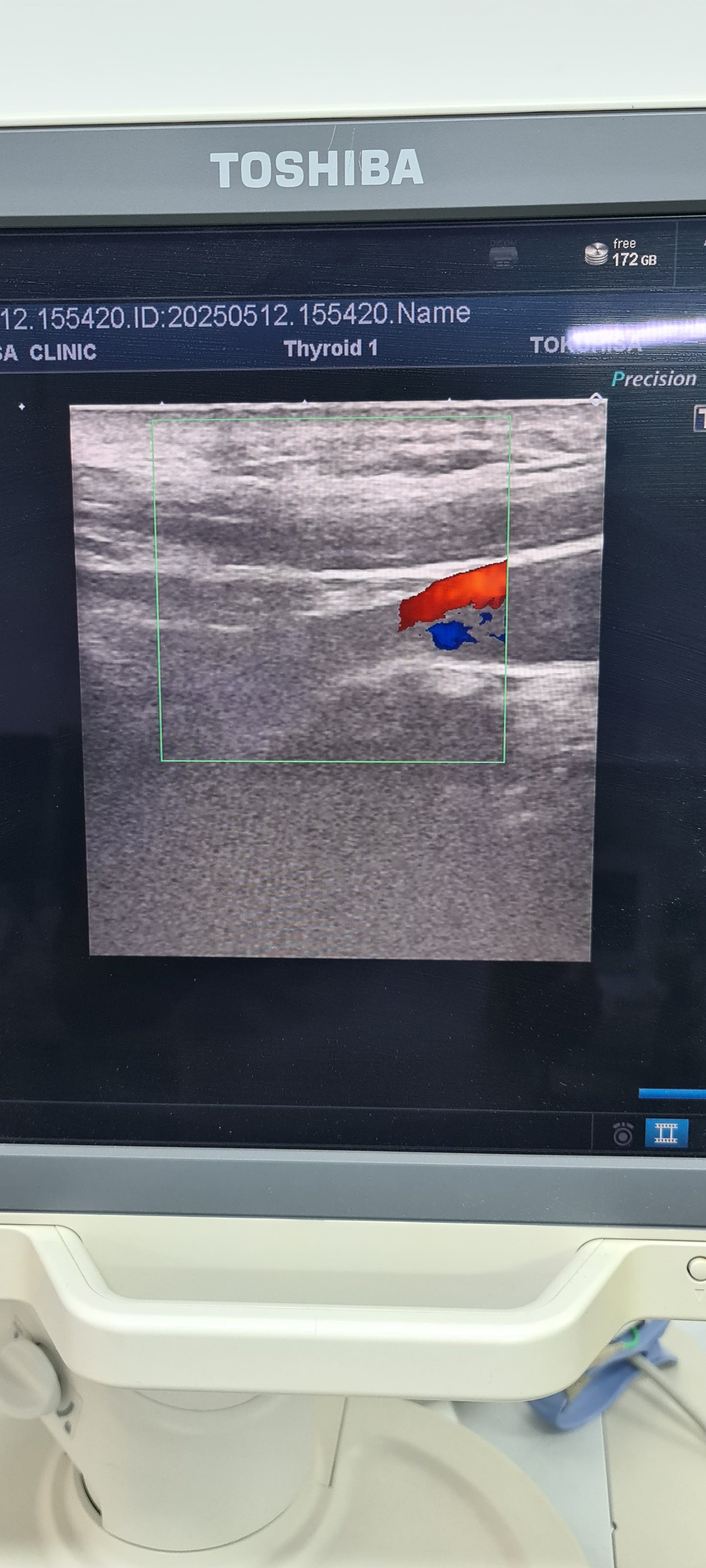 Toshiba PLT-704AT Convex Prob SN: 99A0635844 checked dxb
