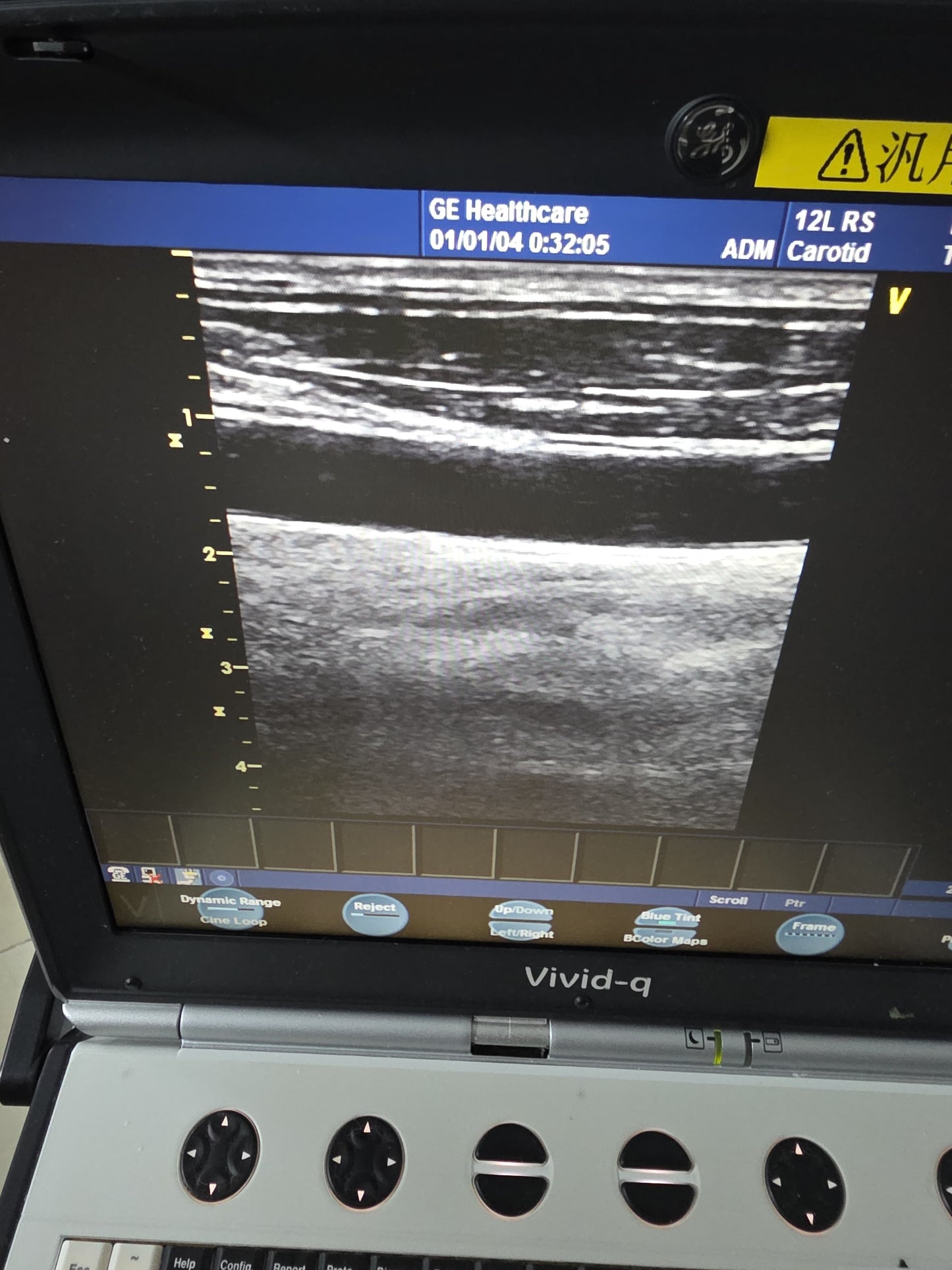 GE 12L RS linear probe SN: 132095YP1