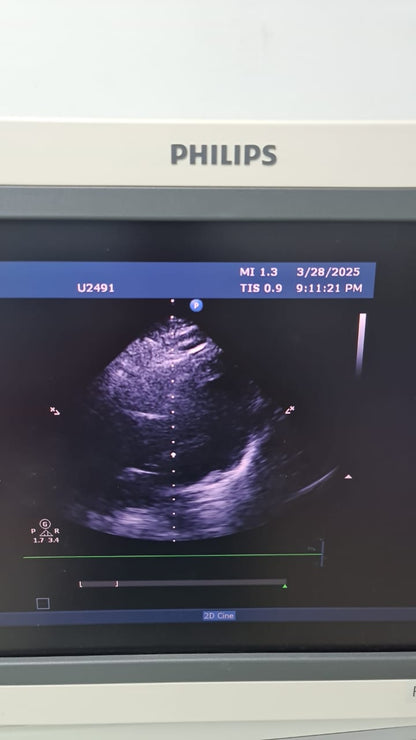 Philips S5-2 Prob cardiac checked