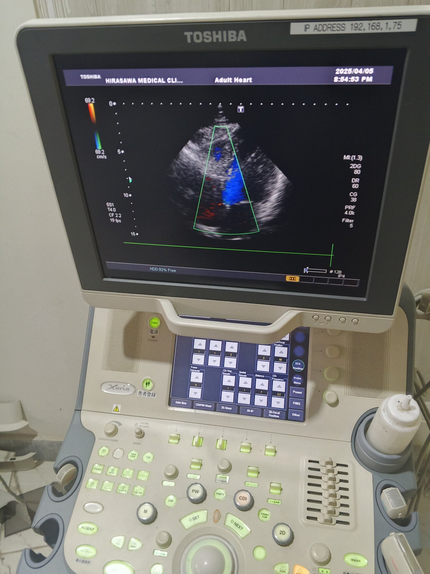 Toshiba PST-25BT cardiac probe