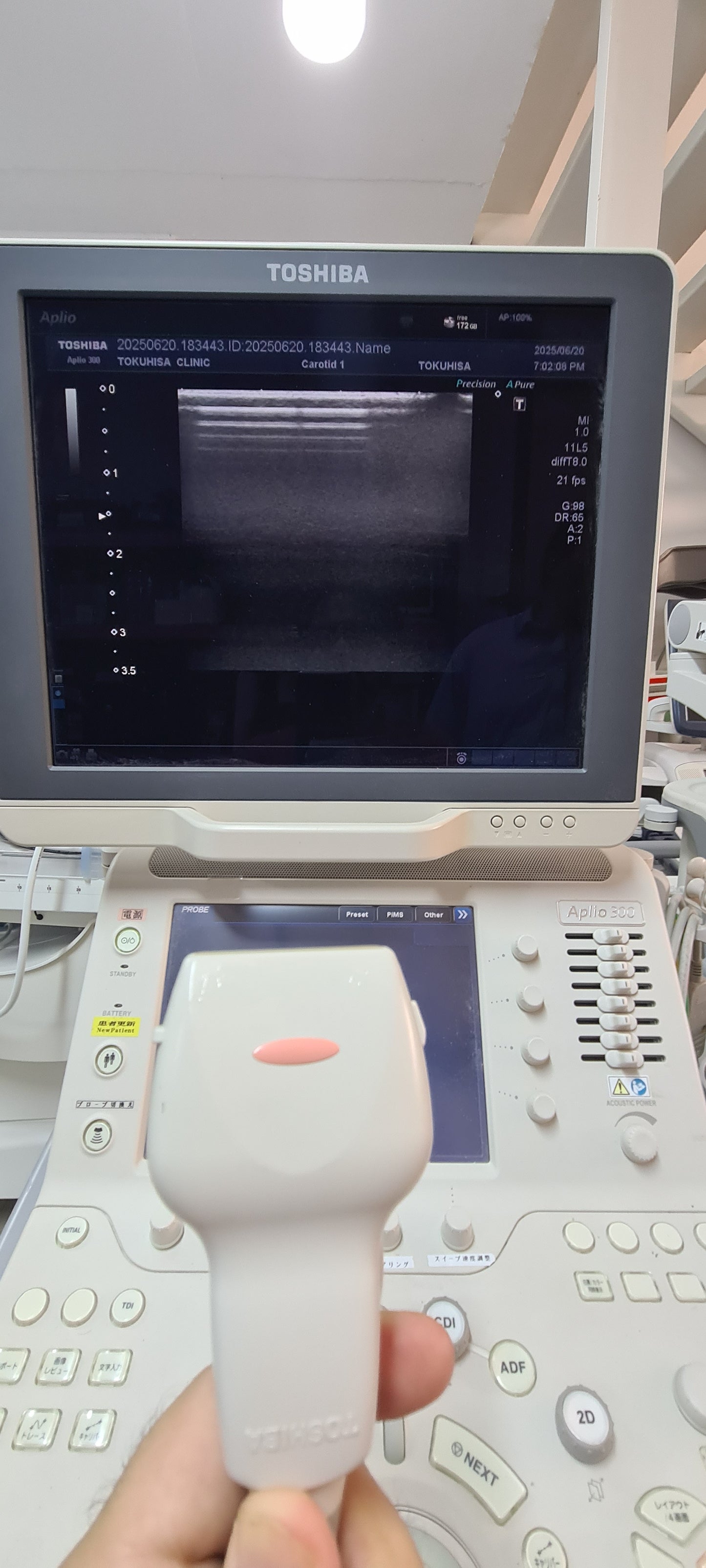 Toshiba PLT-704AT Linear probe SN: TDA12Y5713 Dxb