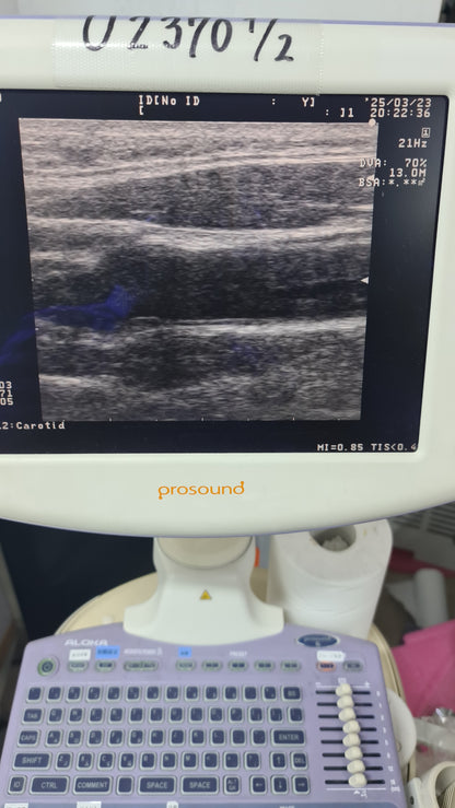 Aloka UST-5413 prob L  checked SN. X0032974