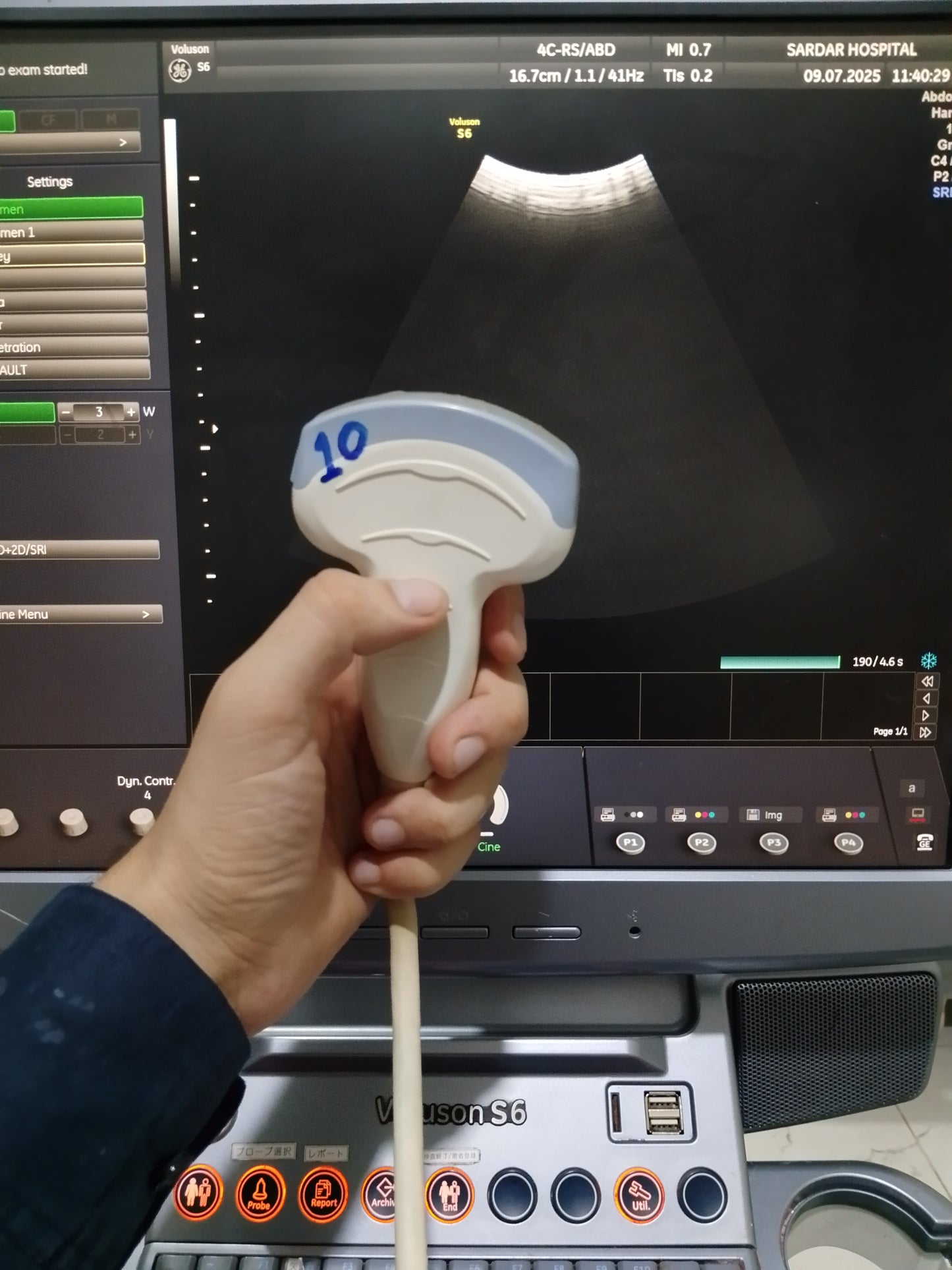 P..4c-RS convex probe (10)