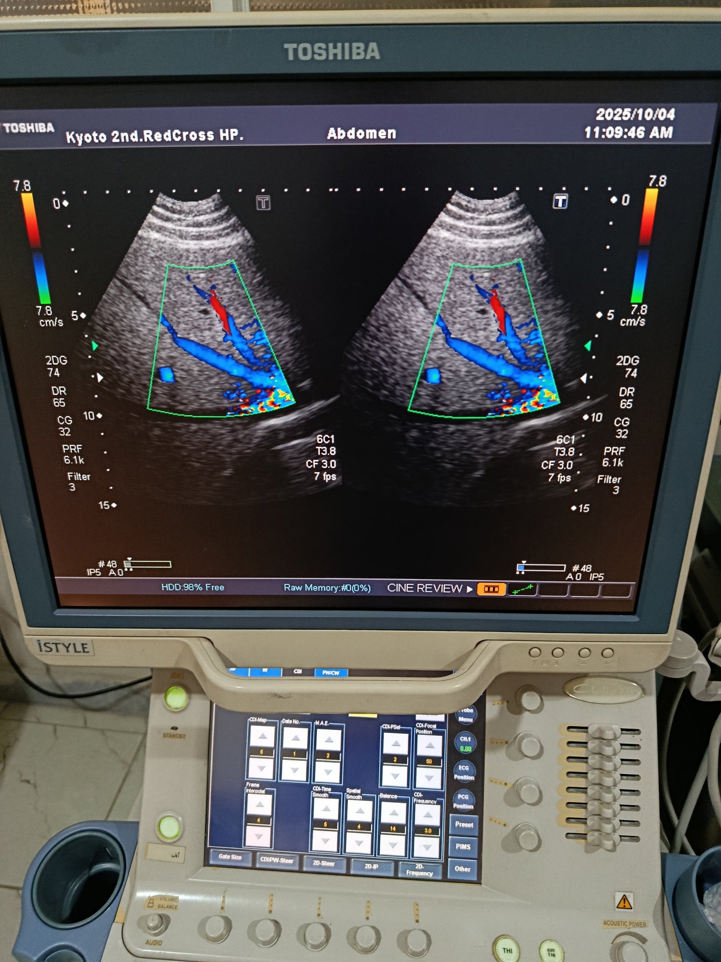 P..Toshiba PVT-382BT Cardiac Probe UC