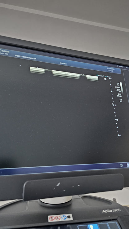 Canon i18LX5 model: PLI-1205BX Linear array transducer Mfg: 01-2018 UC