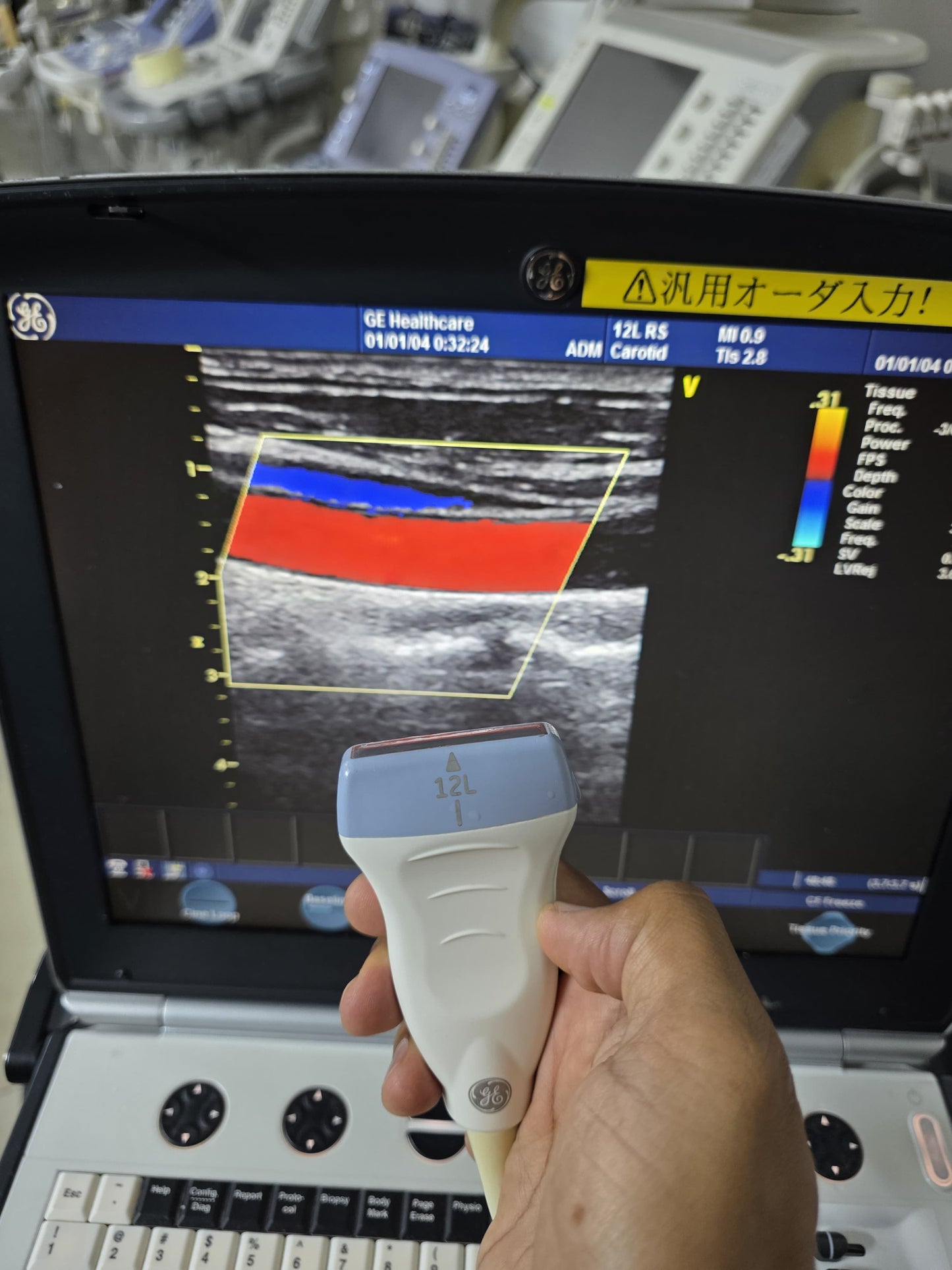 GE 12L RS linear probe SN: 132095YP1