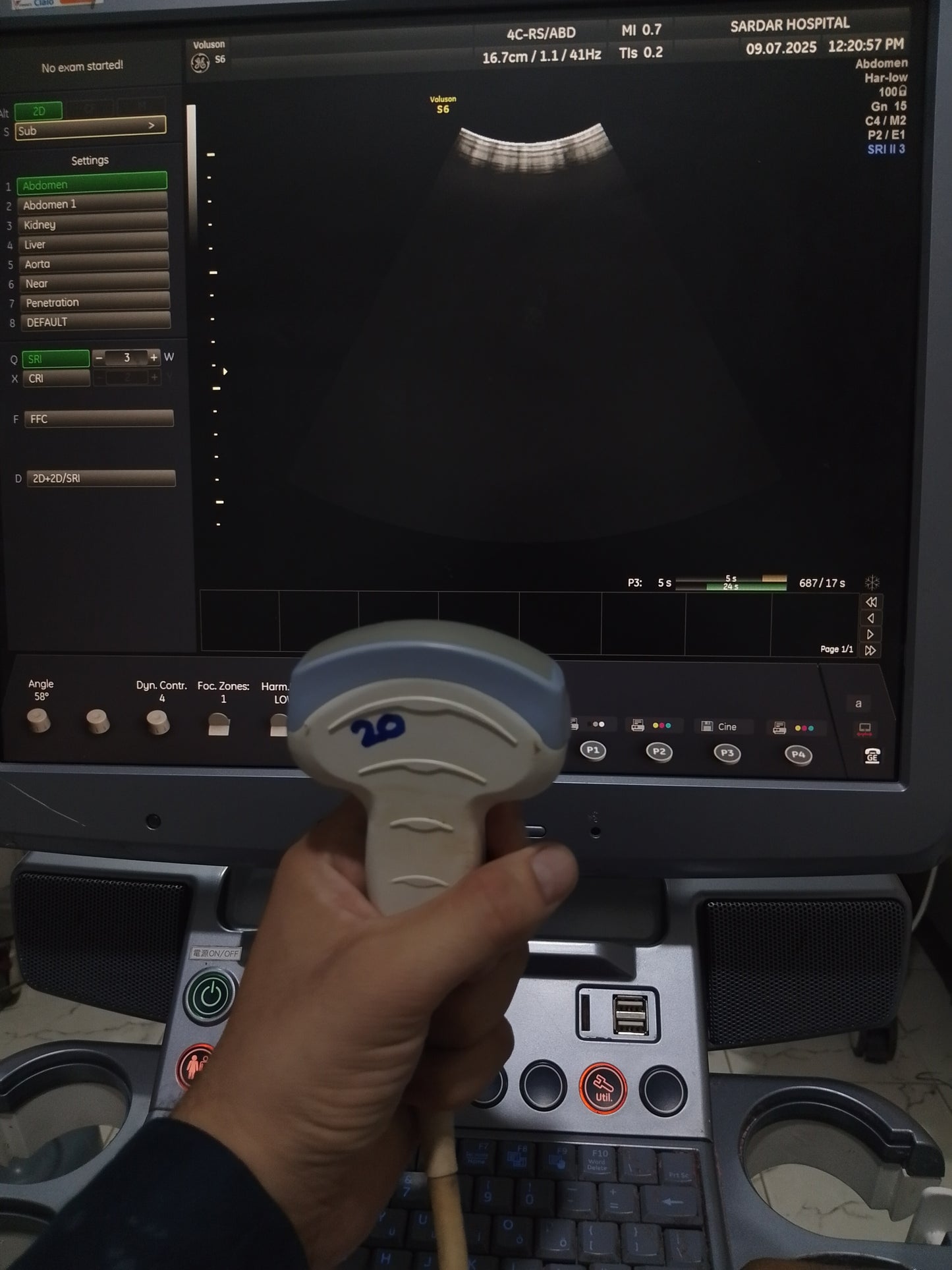 P..4c-Rs convex probe(20)
