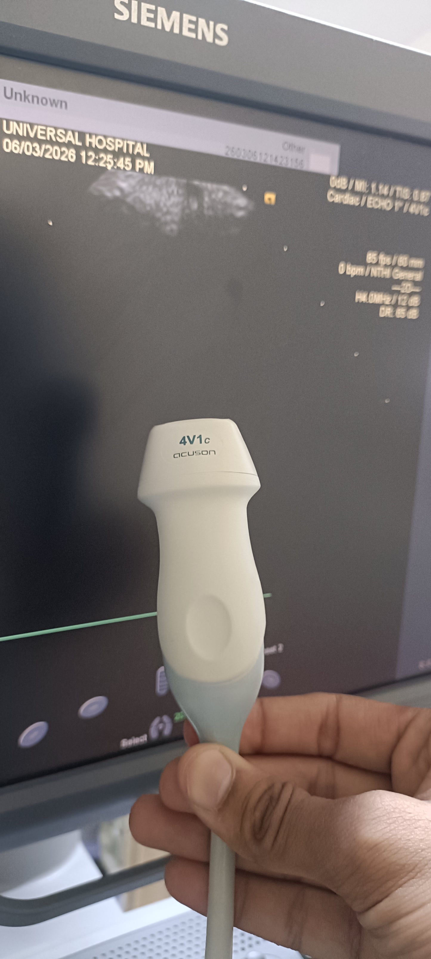 Siemens cardiac probe sn. 00485607 moy. 2010 checked dxb IS (MW) - Japan Medical Company LTD