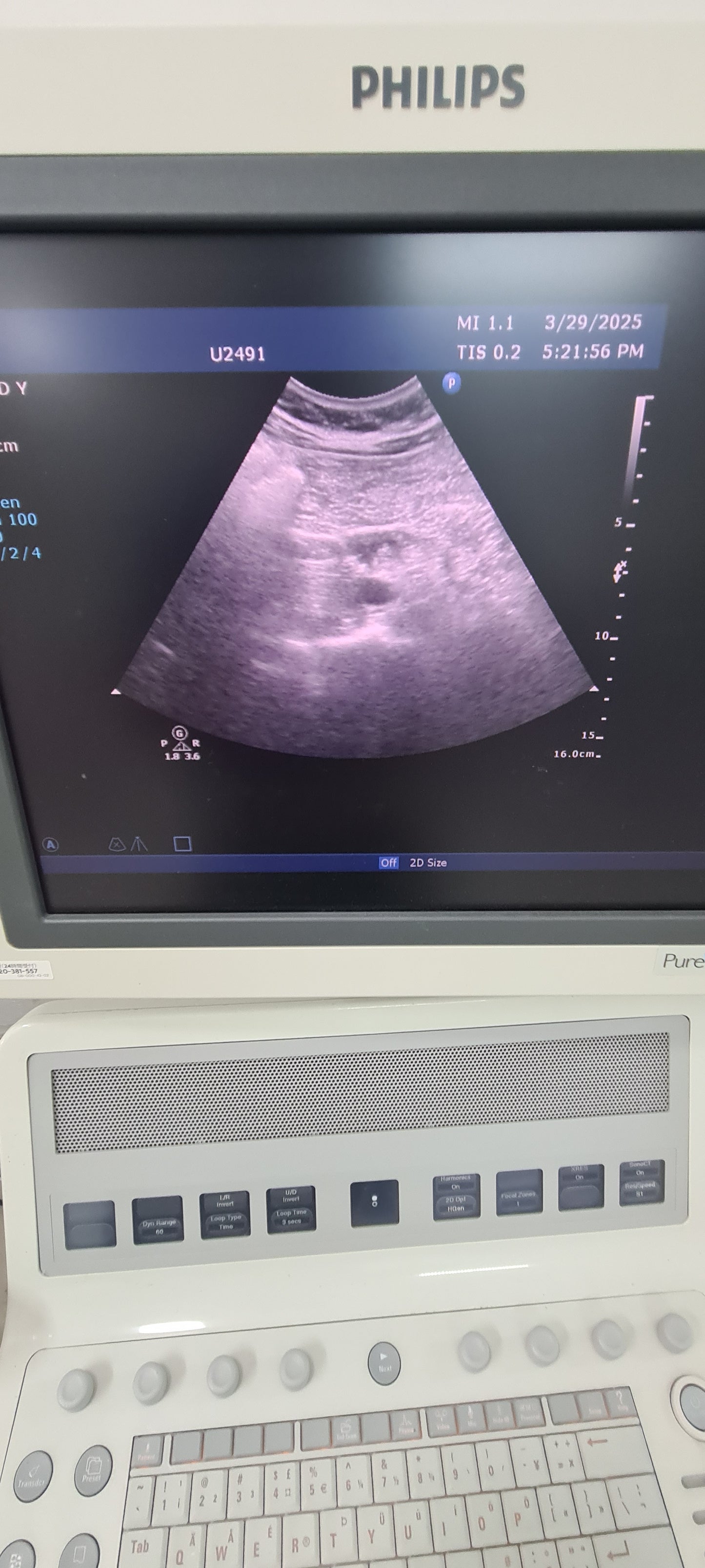 Philips C5-1 prob Convex checked B0QHBG  453561224465