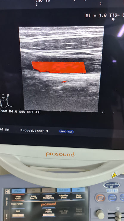 Aloka prob UST-5412 SN. M03744 checked