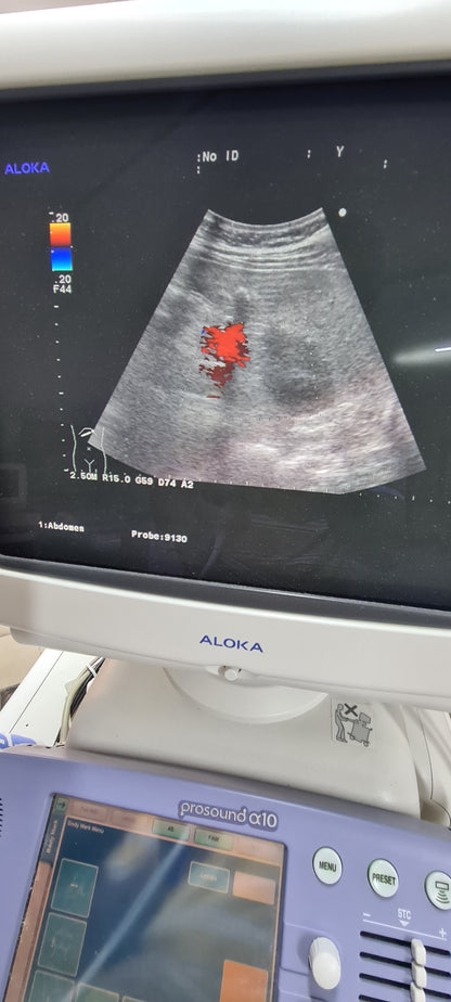 Aloka UST-9130  CONVEX checked Av. SN. X0061338
