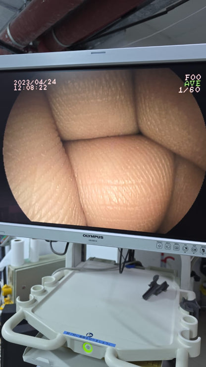 Fujinon ED-530XT8 Deudenoscope SN 4D103A117 checked DXB