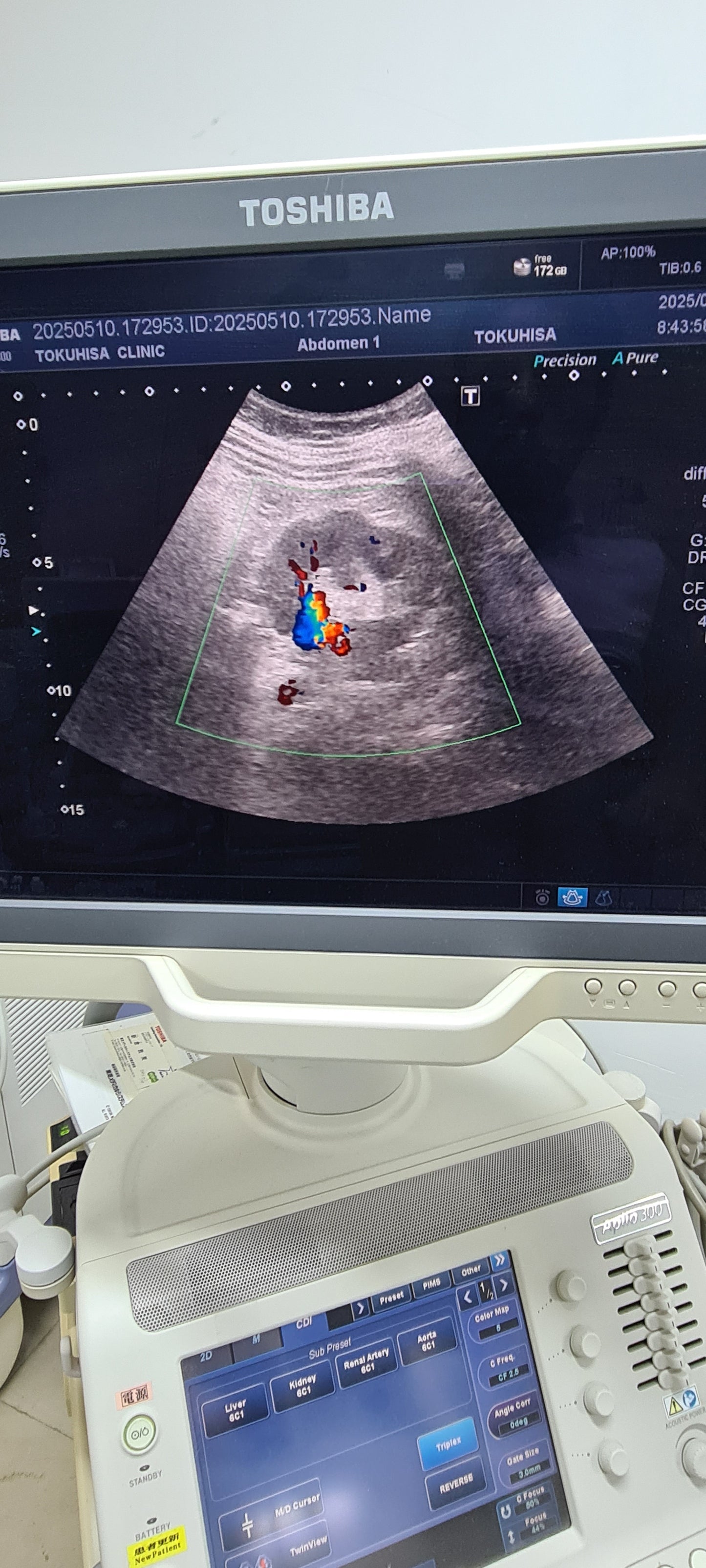 Toshiba 6C1 Convex Prob  Checked SN: FDA1262270 dxb